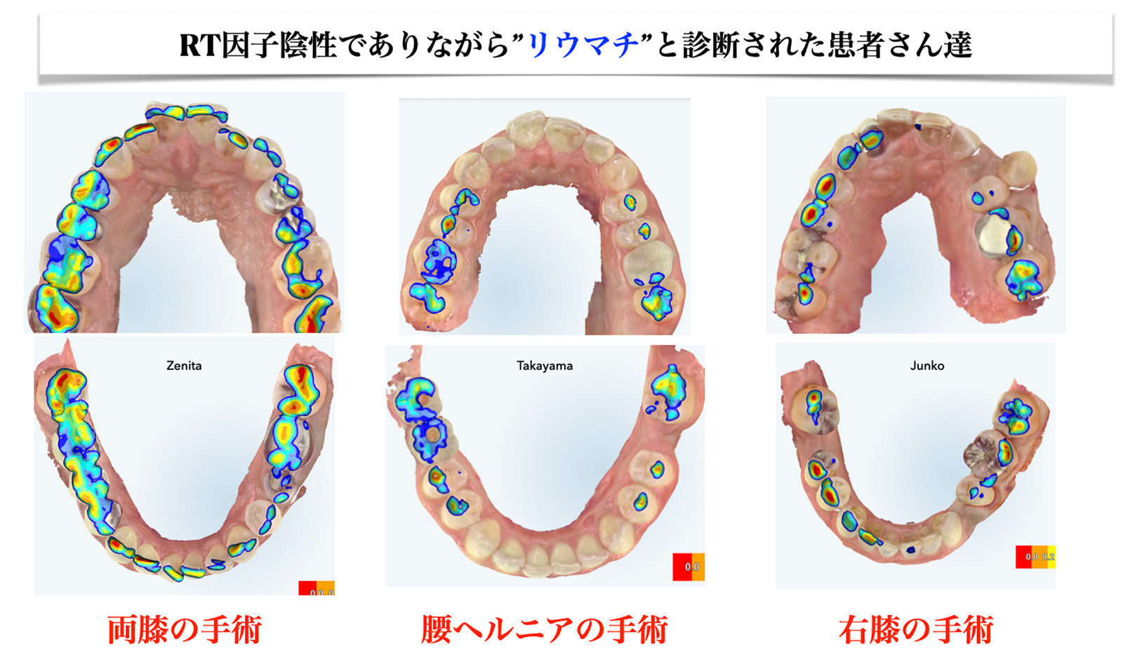「たった1mmが、全身を変える」