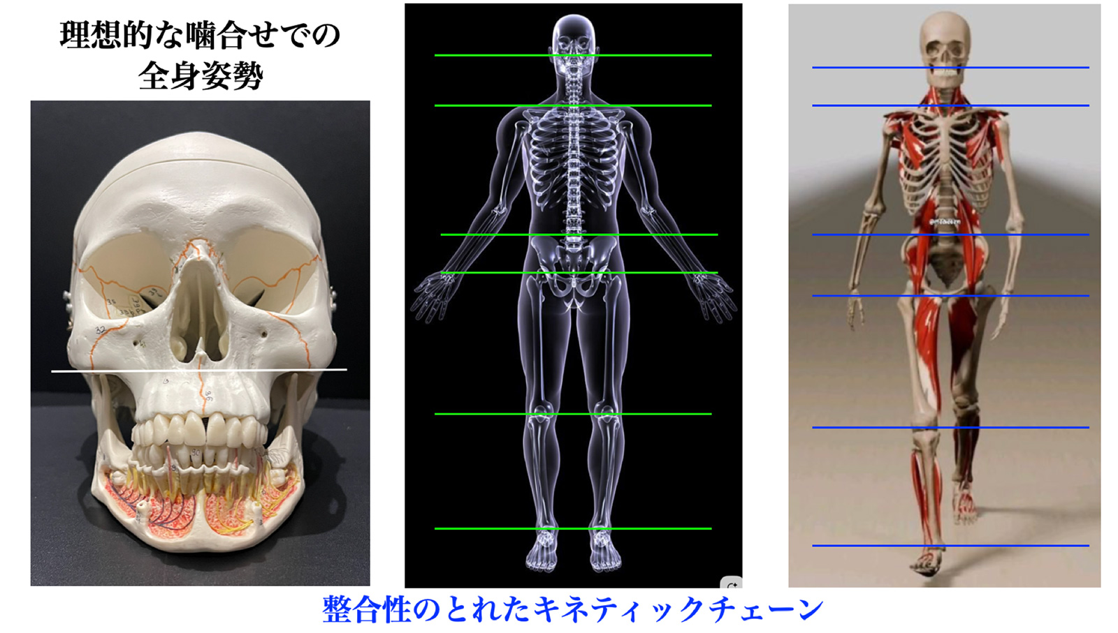 Unbreka®︎アンブレカ